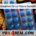 Imágenes De La Píldora Tadalafil viagra2